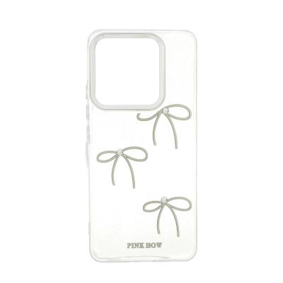 قاب رزینی طرح برجسته لنز سیلور Xiaomi Redmi Note 14 4G - کد 573 - MPS