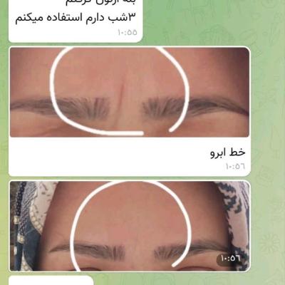 کرم ضدچروک بیوممتیک