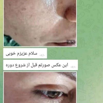 بیوممتیک جوانساز