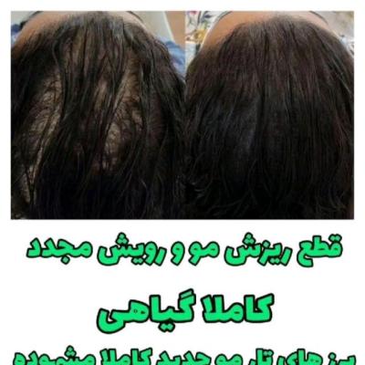 شامپو ضد ریزش و تقویت کننده مورینگا